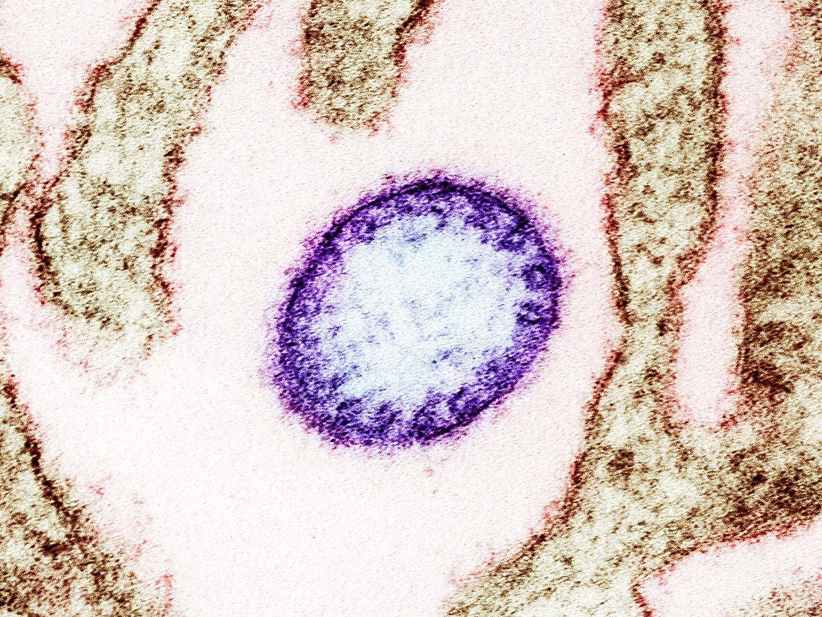 The Next Big&nbsp;One